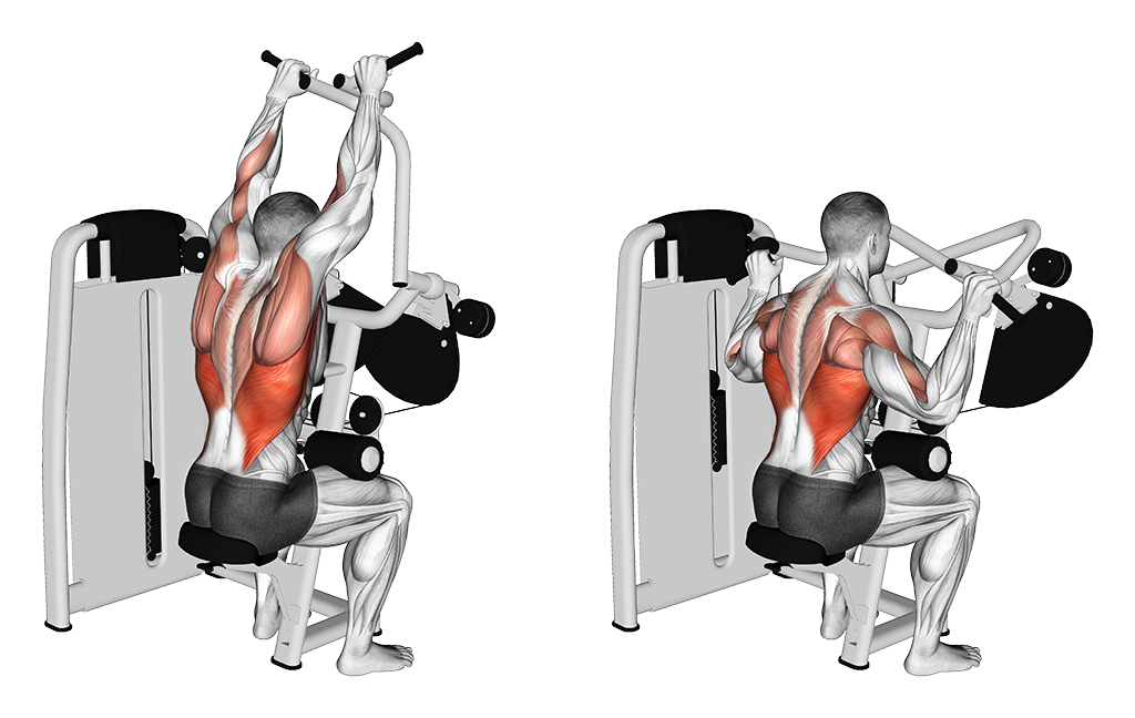 Machine Cross Lat Pulldown