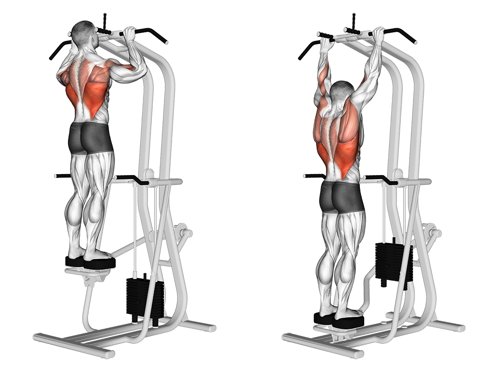Machine Assisted Pull-Up – Standing